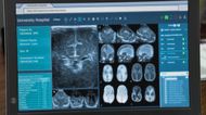The Bold and the Beautiful: Was Liam's brain scan fabricated? | Image: CBS